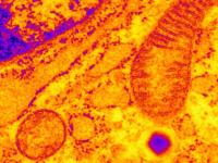 How calcium affects pancreatic cell function